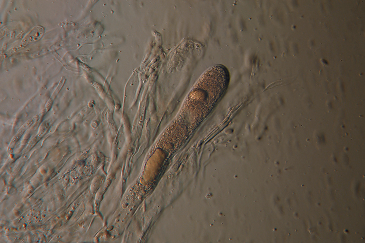 Aleurodiscus amorphus (Fr.)Schroeter